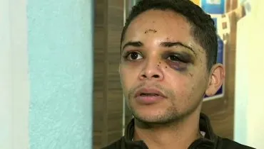 Frentista agredido com garrafa em posto de Curitiba levou 8 pontos no rosto; 