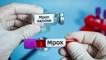 8 perguntas e respostas sobre a Mpox